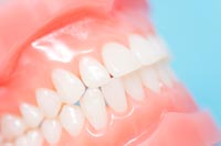 再治療を防ぐための精密歯科治療